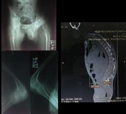 Spine Surgeon in Delhi